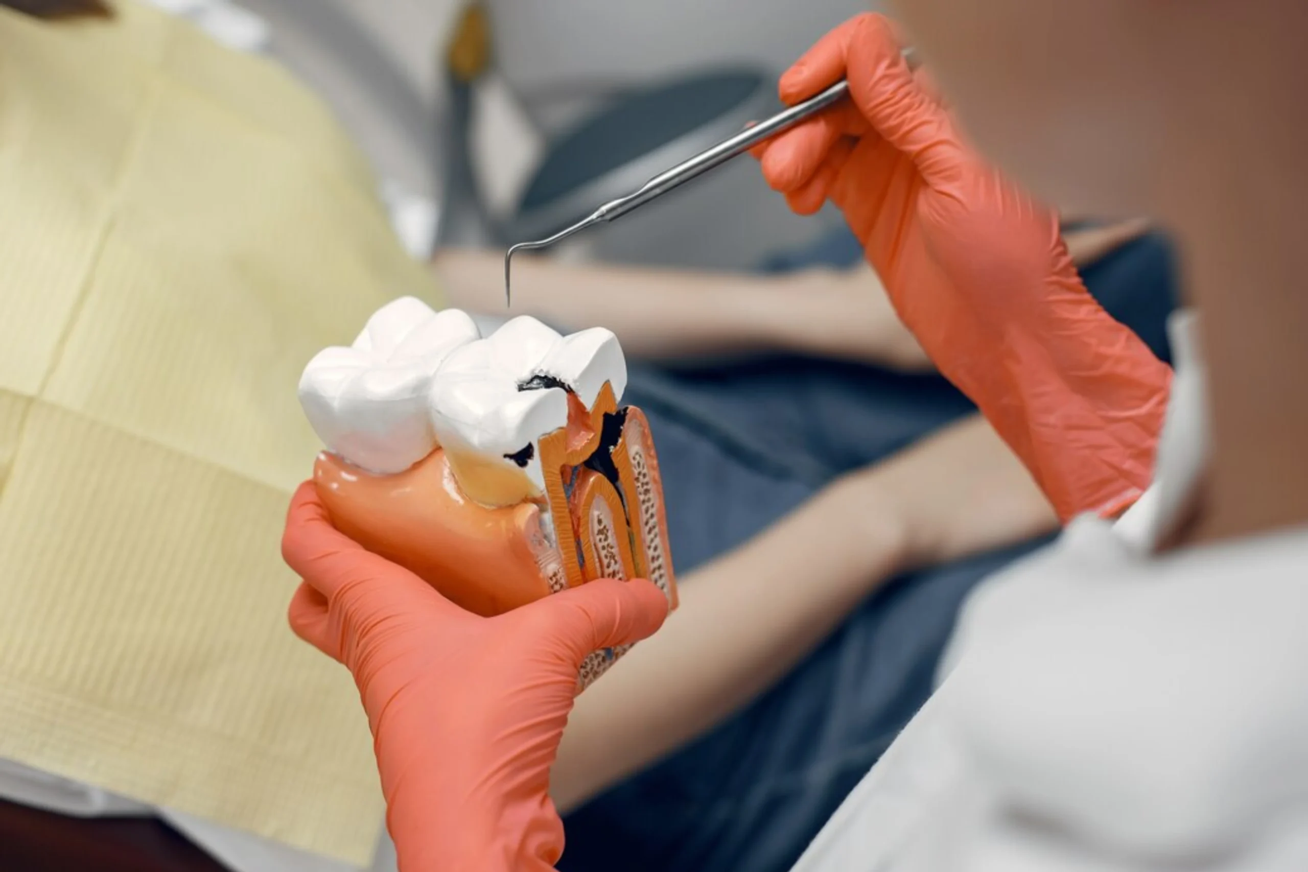 How Painful Is a Root Canal and How Long Does Recovery Take