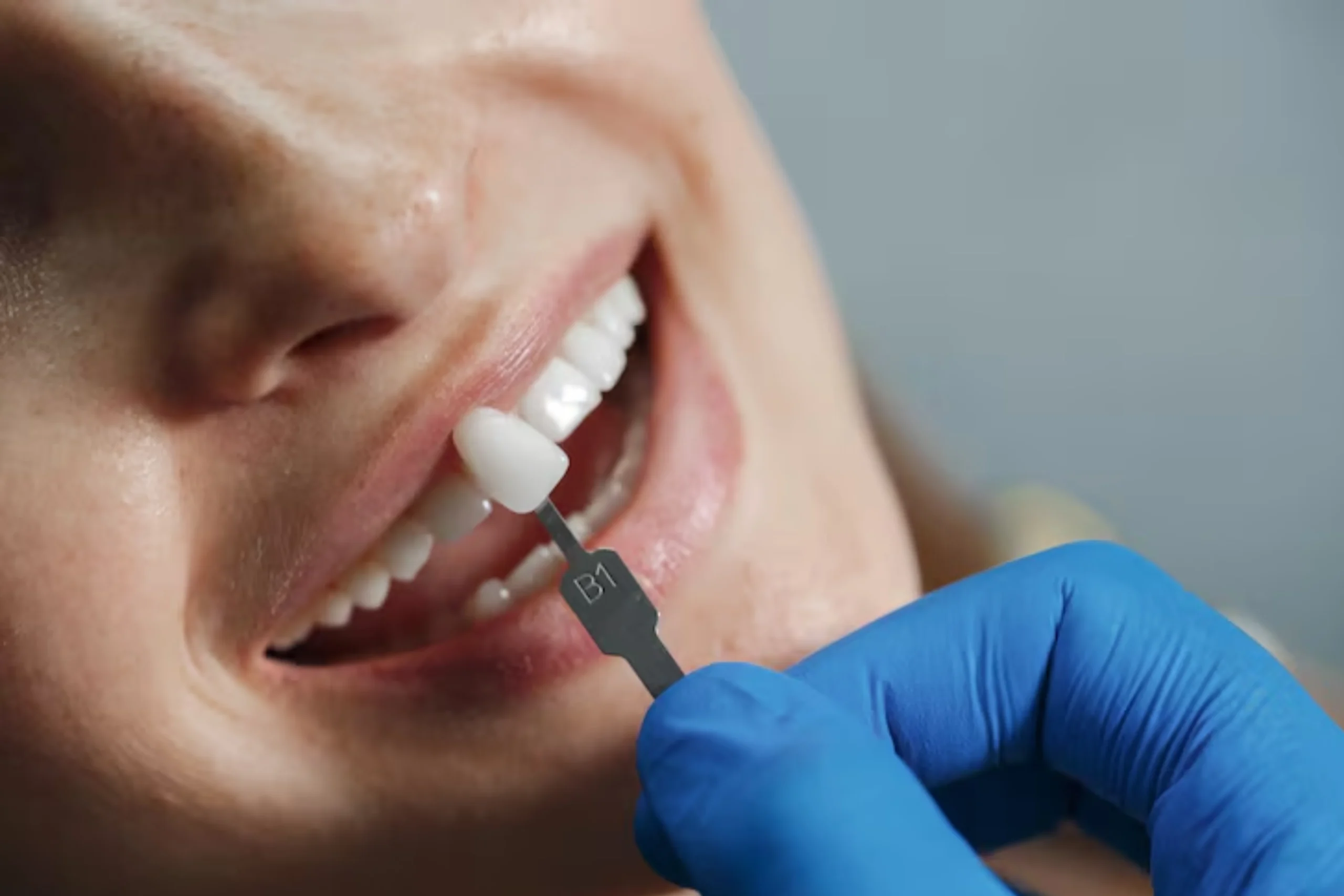 Dental Bridge vs Dental Implant: Which Is Right for You?
