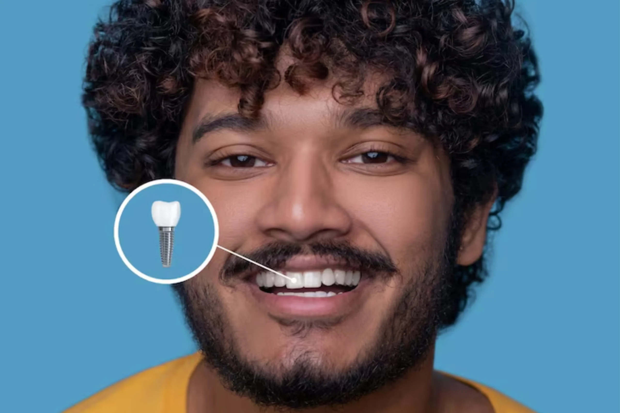 The Difference Between Veneers And Dental Implants For A Healthier Smile