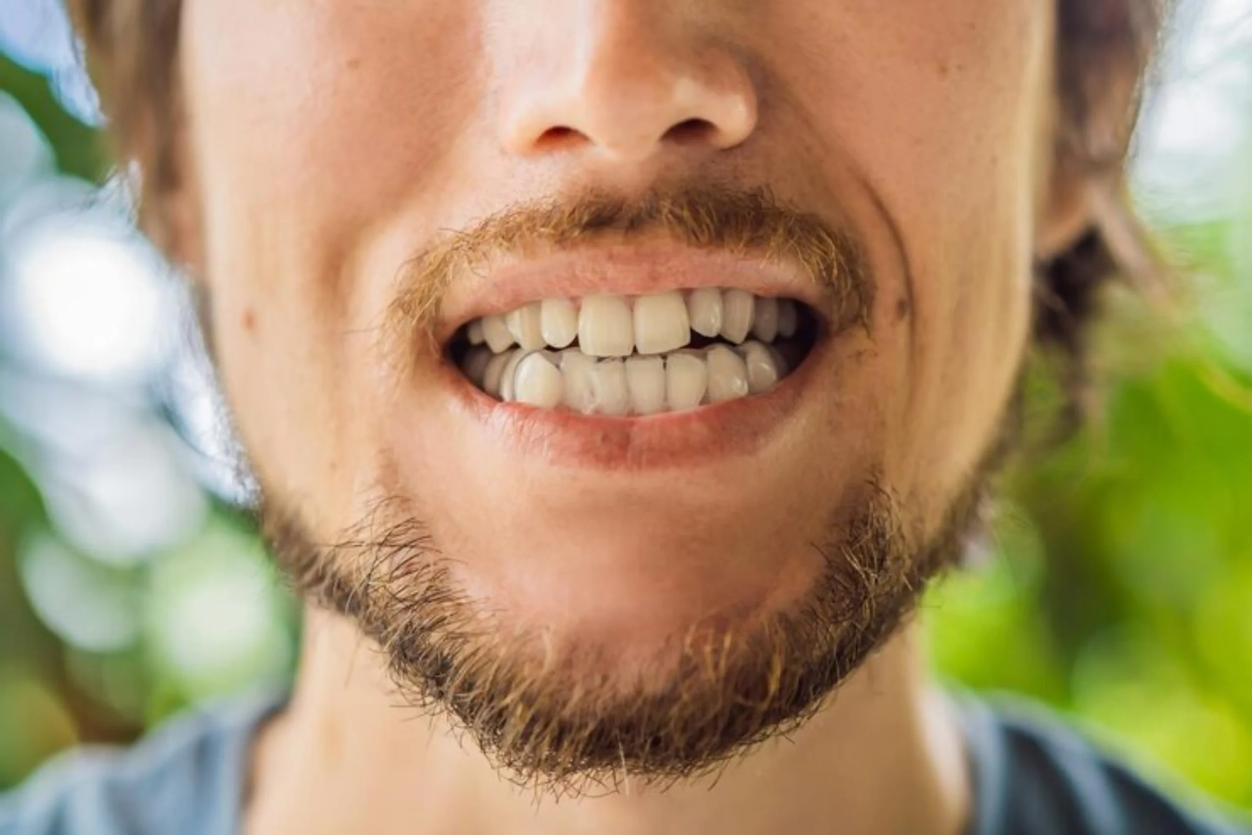 What Causes Teeth Grinding and How Does It Affect Your Teeth?